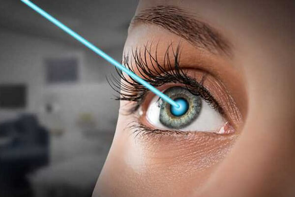 laser eye surgery Hong Kong